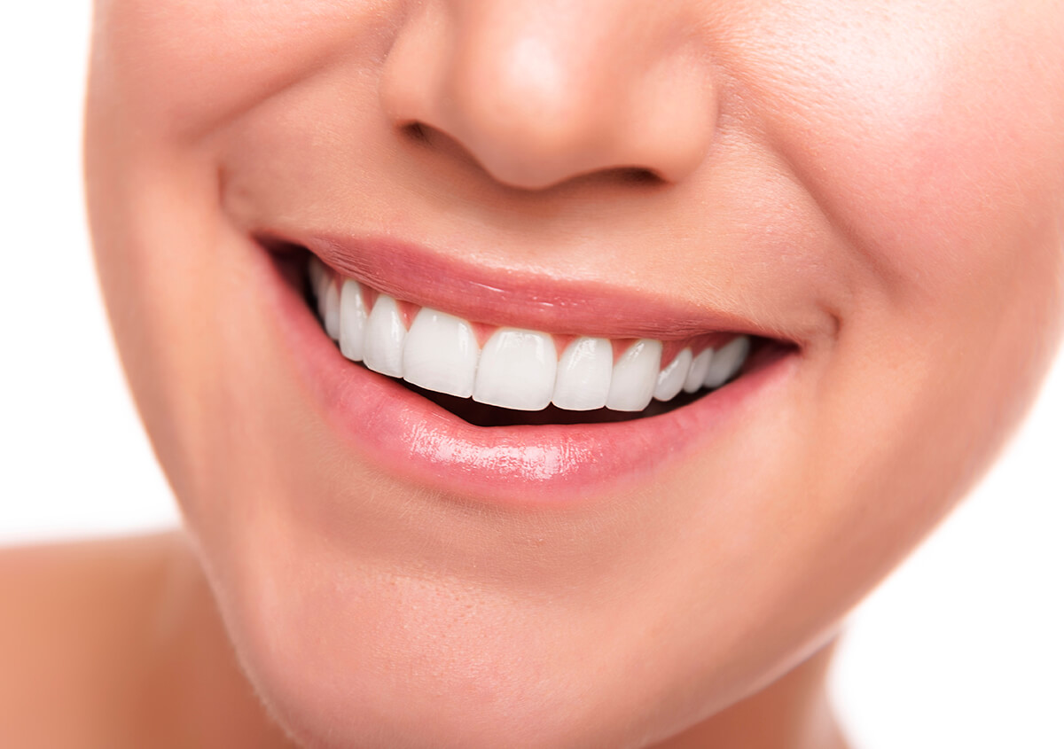 Teeth Whitening Process in Beverly Hills CA Area