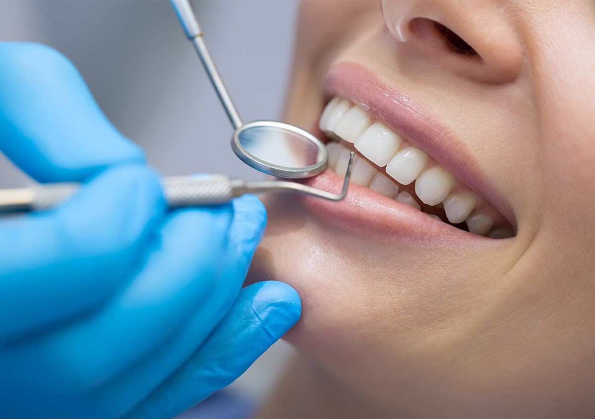 Dental Bonding for Gaps in Beverly Hills CA Area