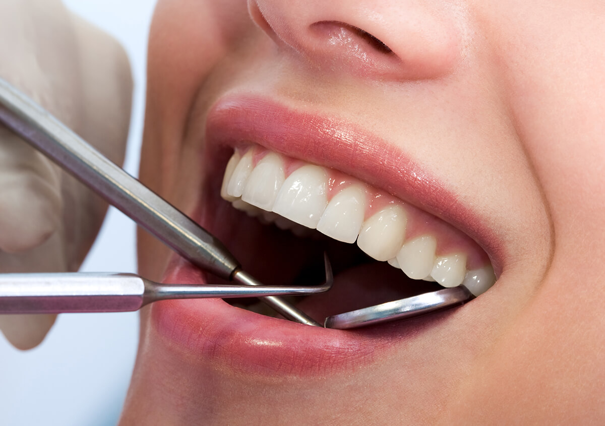Teeth Whitening Options in Beverly Hills Area