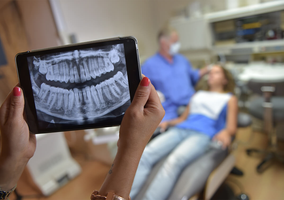 What is Dental Imaging in Beverly Hills Area