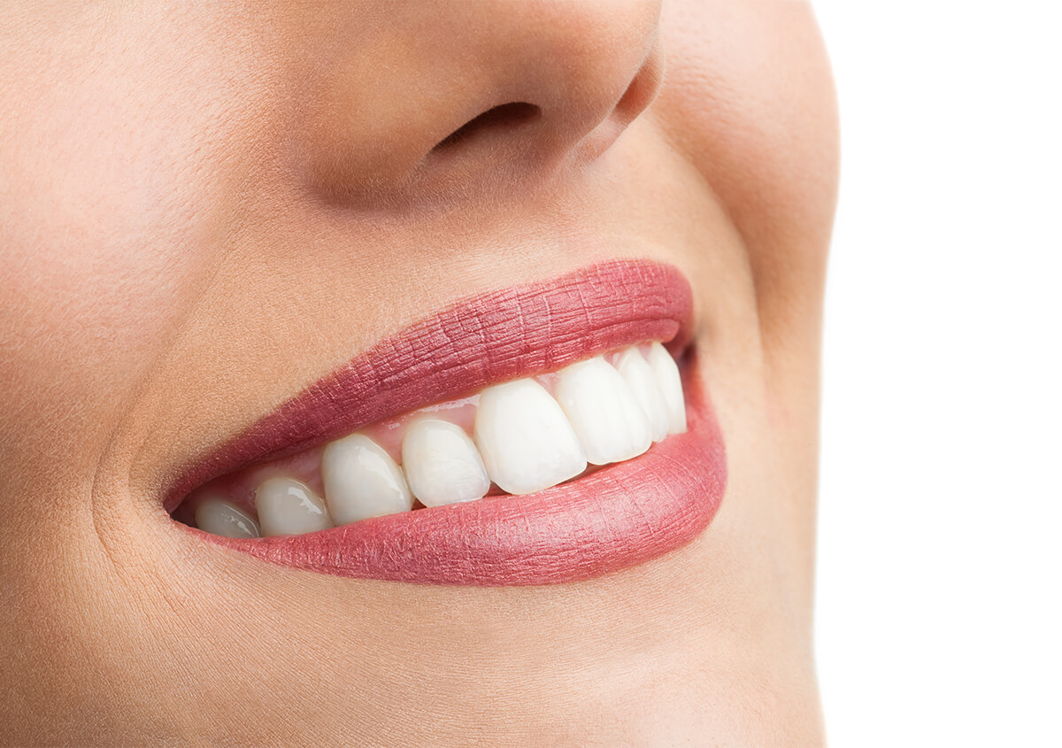 Teeth Whitening Service in Beverly Hills Area