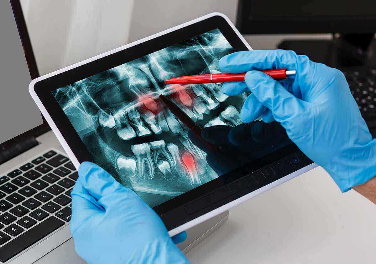 Digital Imaging in Dentistry in Beverly Hills CA Area